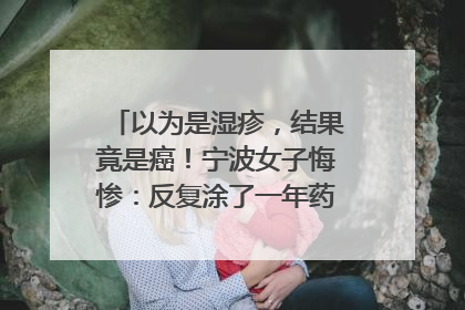 以为是湿疹，结果竟是癌！宁波女子悔惨：反复涂了一年药膏都没好！很多患者首诊都去了皮肤科